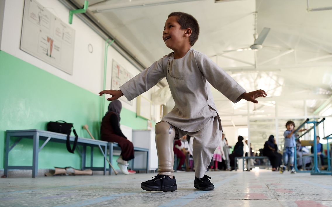 Ahmad Sayed Rahman dancing with his prothesis